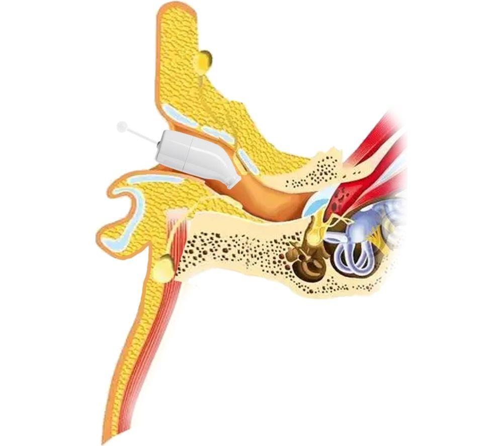 CERETONE Core One Pro CE-A80 In-Ear Canal Hearing Aids - Beige